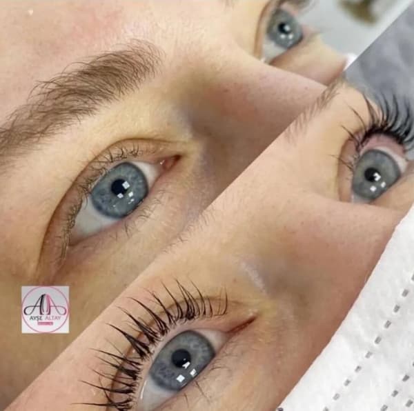 Ayşe Alya Güzellik Merkezi - 84. Fotoğraf Ayşe Alya Güzellik Merkezi - 84. Fotoğraf