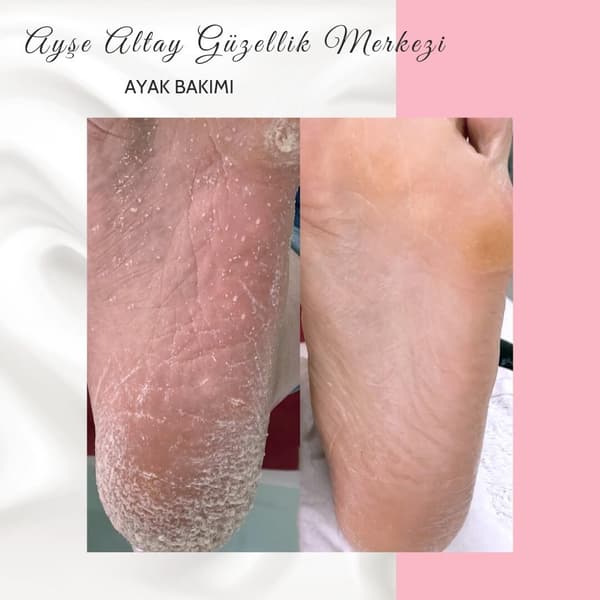 Ayşe Alya Güzellik Merkezi - 158. Fotoğraf Ayşe Alya Güzellik Merkezi - 158. Fotoğraf