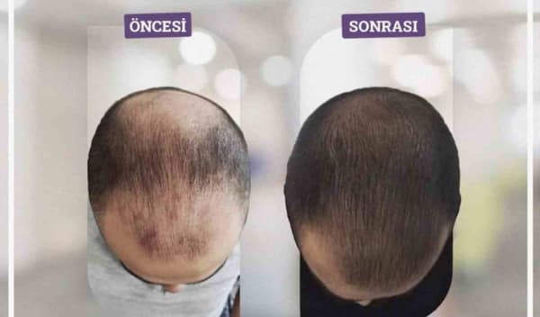 Touch Güzellik Salonu - 2. Fotoğraf