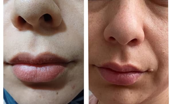 Touch Güzellik Salonu - 7. Fotoğraf