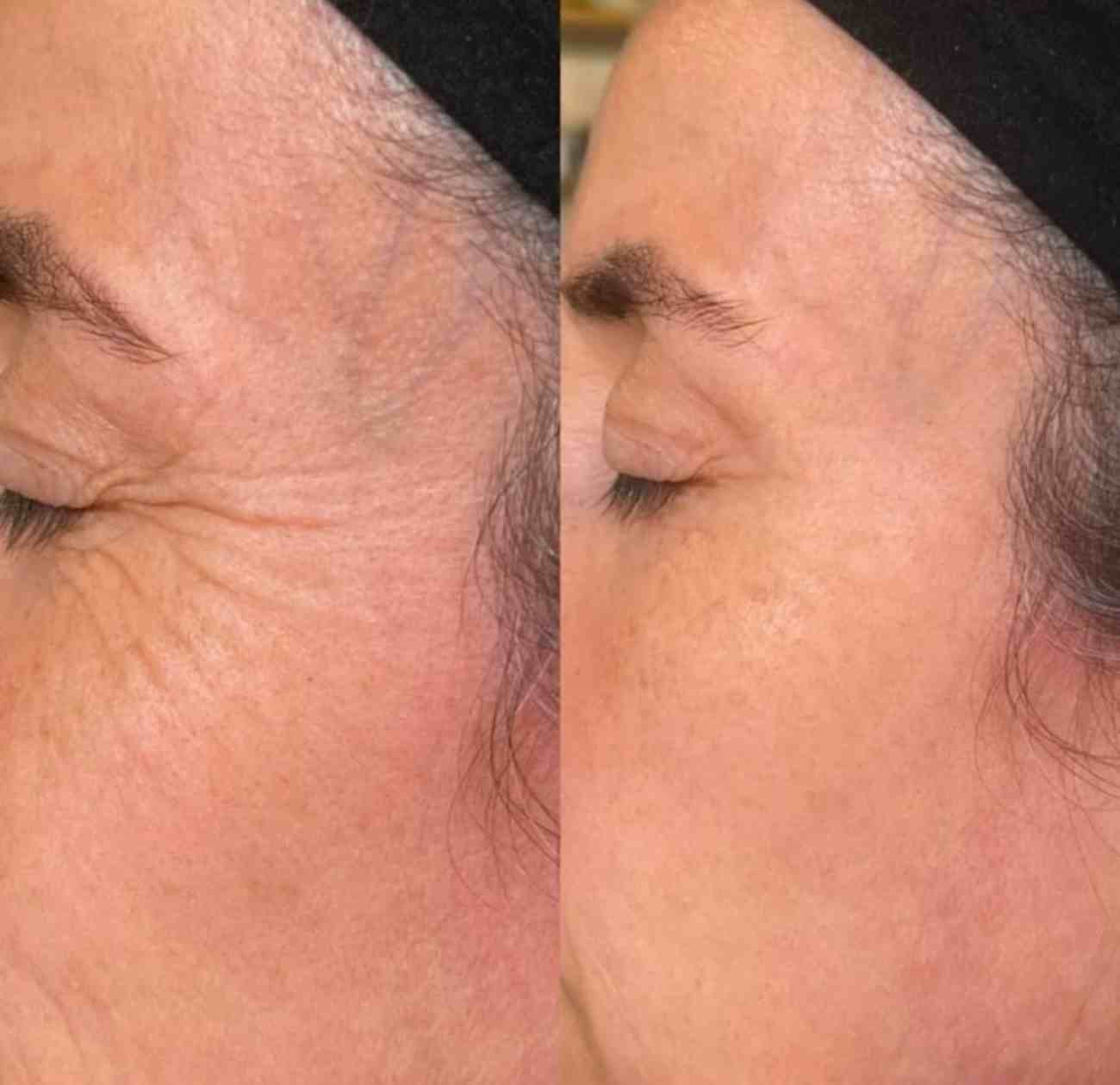 Touch Güzellik Salonu - 3. Fotoğraf