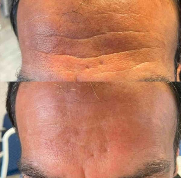 Touch Güzellik Salonu - 6. Fotoğraf