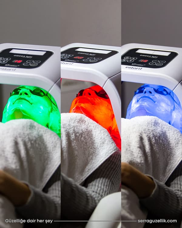 Serra Güzellik - 14. Fotoğraf Serra Güzellik - 14. Fotoğraf