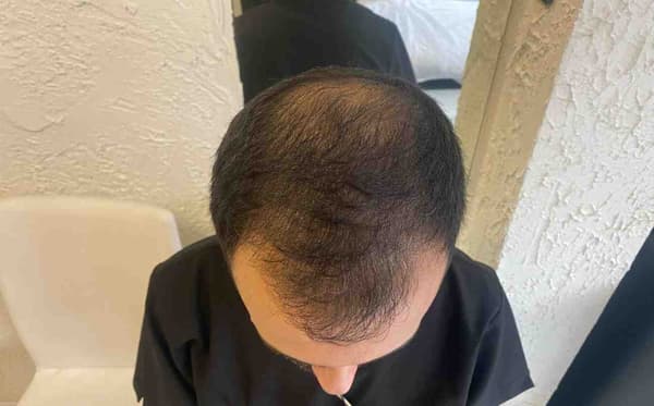 Cool Touch Beauty - 8. Fotoğraf Cool Touch Beauty - 8. Fotoğraf