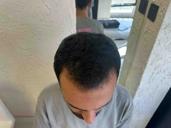 Cool Touch Beauty - 7. Fotoğraf Cool Touch Beauty - 7. Fotoğraf