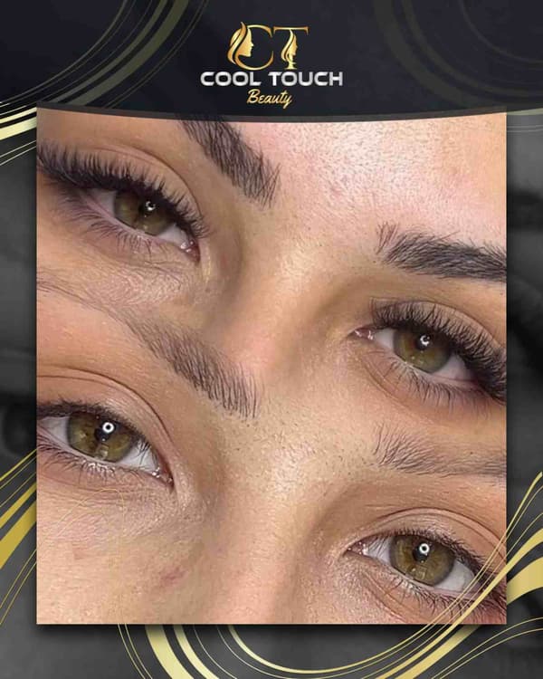 Cool Touch Beauty - 1. Fotoğraf Cool Touch Beauty - 1. Fotoğraf